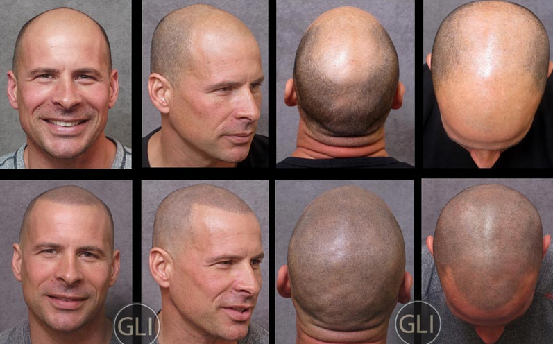 Tatto shaved head Action36 mature pic